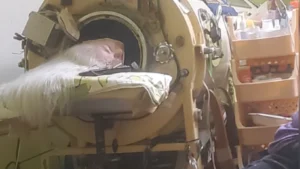 La mujer que vivió 73 años metida varias horas al día en un pulmón de acero que le permitía respirar