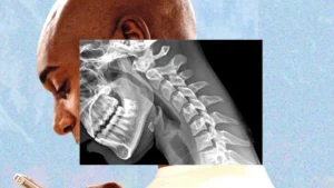 «Cuerpo de teléfono»: cómo la tecnología nos arruga el cuello y debilita las manos