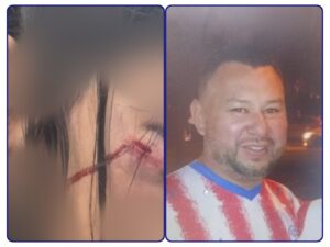 APREHENDEN A UN HOMBRE POR SUPUESTO HECHO DE VIOLENCIA FAMILIAR EN PEDRO JUAN CABALLERO