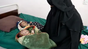 «Solo piel y huesos»: los gemelos recién nacidos que tratan de sobrevivir a la guerra y el hambre en Yemen